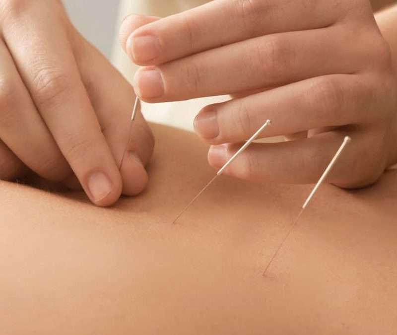 Debunking the Acupuncture Myth