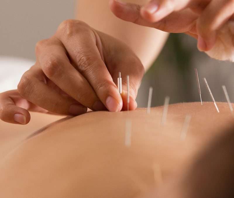 Acupuncture for Chronic Pain in Vancouver